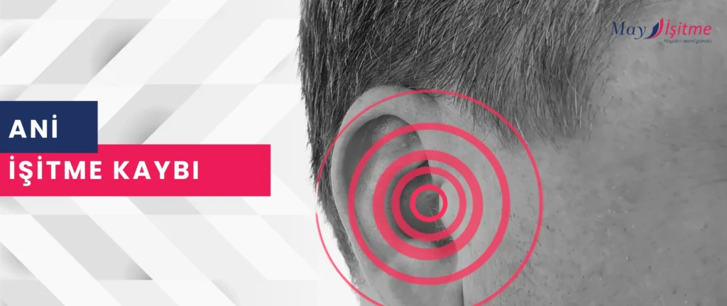 Ani İşitme Kaybı Tedavisi Mümkün müdür?